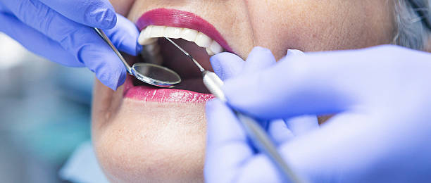 Best Dentist for Tooth Abscess  in Fulton, IL